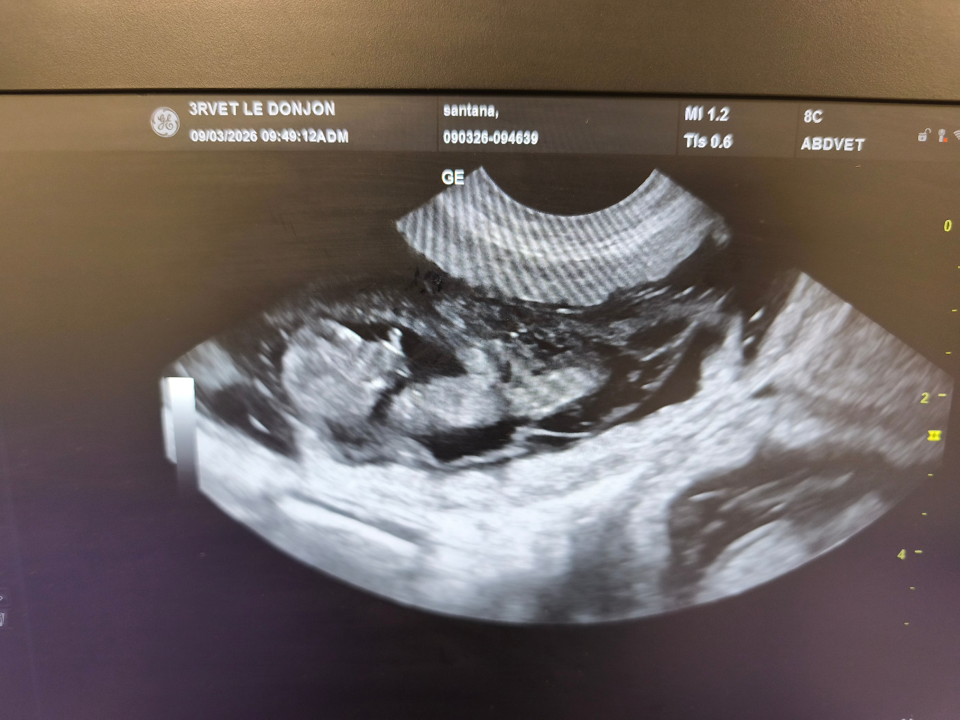 NAISSANCES ATTENDUES AUOUR DU 07/04/26